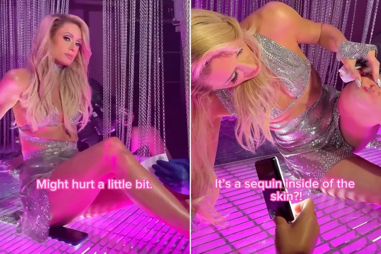 paris hilton cuts leg instagram 090224 4813 e660d65acf0e48618e66228bfe4d3e50